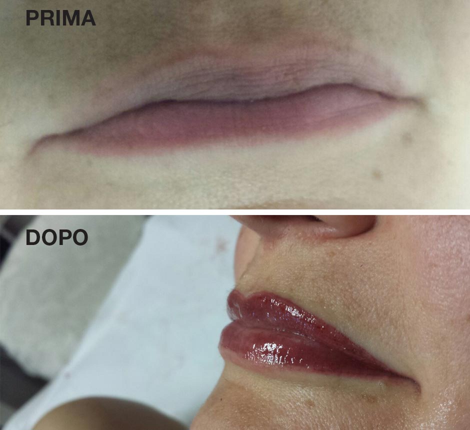 Trucco Semipermanente Labbra Prima e Dopo - Rosy Di Dato Dermopigmentista