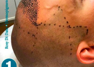 Progettazione Tricopigmentazione Uomo | TRICODERMSOLUTIONS