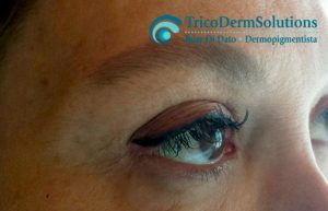 Trucco Semipermanente Eyeliner | TRICODERMSOLUTIONS