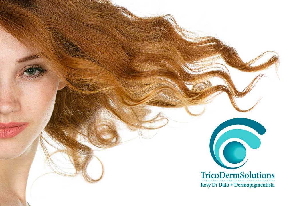 Alopecia Femminile | TRICODERMSOLUTIONS