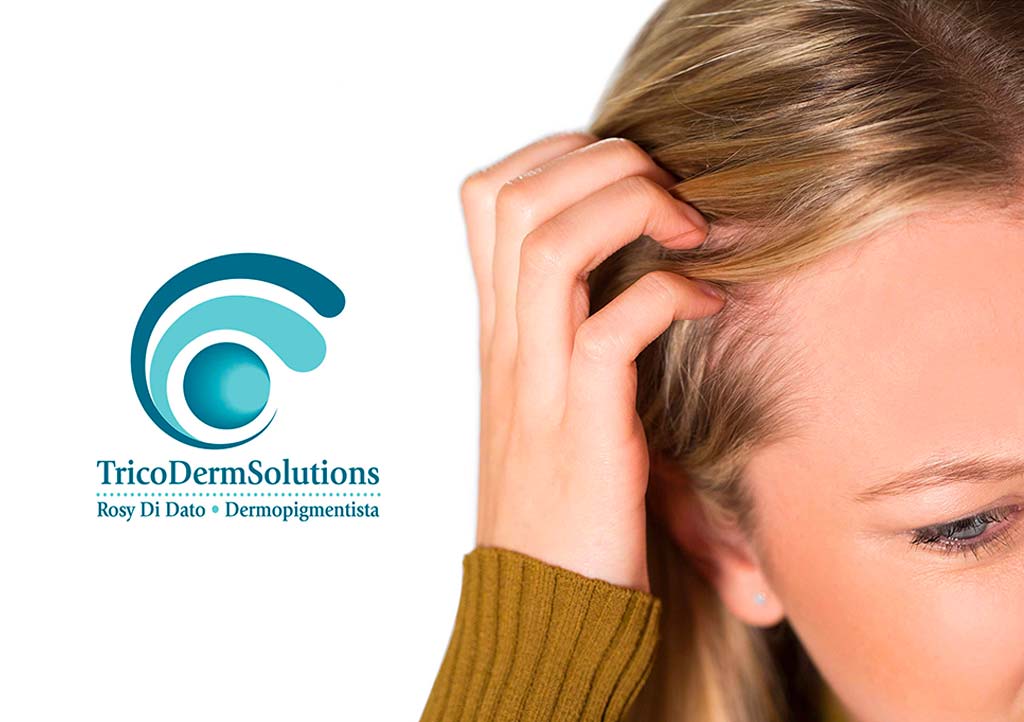 Alopecia e Tricopigmentazione | TRICODERMSOLUTIONS