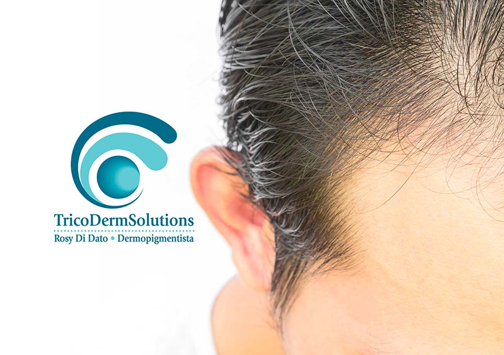 Diradamento Capelli | TRICODERMSOLUTIONS