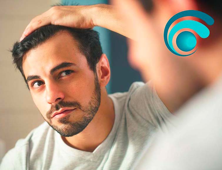 Alopecia androgenetica  o calvizie | TRICODERMSOLUTIONS