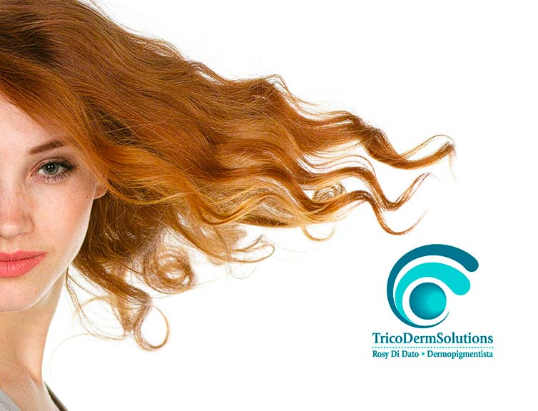 Calvizie Femminile | TRICODERMSOLUTIONS