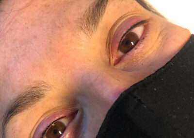 Trattamento semipermanente linea infracigliare | TRICODERMSOLUTIONS